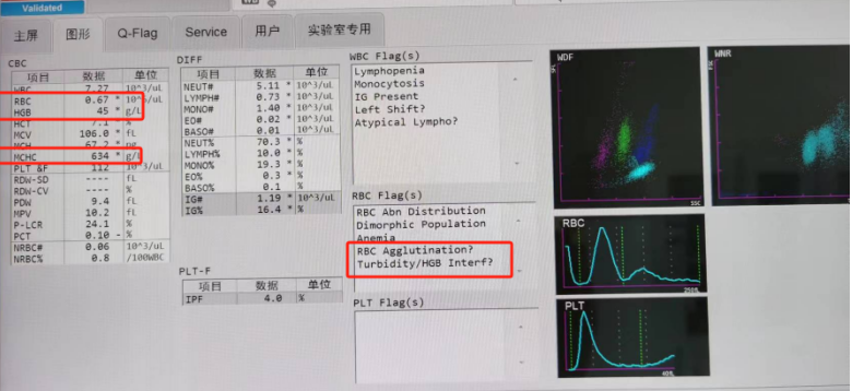 rbc直方图怎么看血常规审核：「三三原则」从哪来？怎么用？这篇说明白了_https://www.jmylbn.com_新闻资讯_第8张