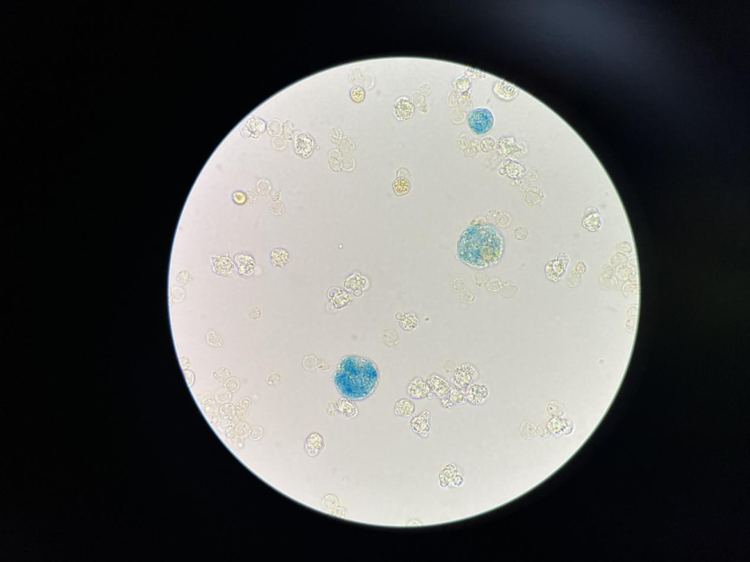 上皮细胞用什么染色尿液中 10 种上皮细胞镜检形态汇总，图片收集全啦！_https://www.jmylbn.com_新闻资讯_第19张