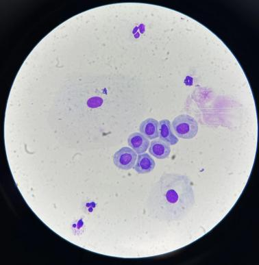 上皮细胞用什么染色尿液中 10 种上皮细胞镜检形态汇总,图片收集全啦!_新闻资讯_第4张_活检穿刺产品网 上皮细胞用什么染色尿液中 10 种上皮细胞镜检形态汇总,图片收集全啦!_https://www.jmylbn.com_新闻资讯_第4张