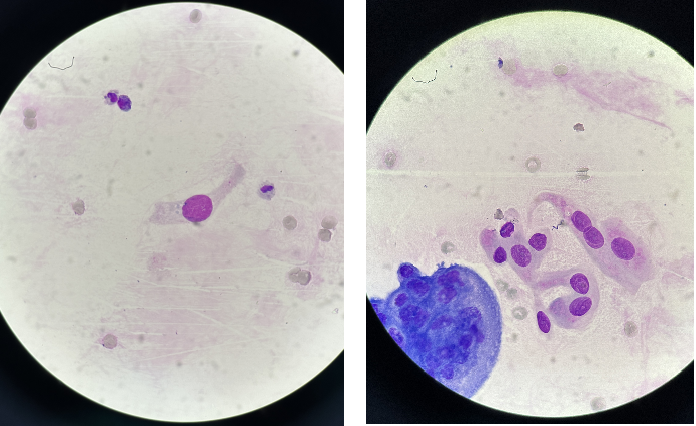 上皮细胞用什么染色尿液中 10 种上皮细胞镜检形态汇总，图片收集全啦！_https://www.jmylbn.com_新闻资讯_第13张