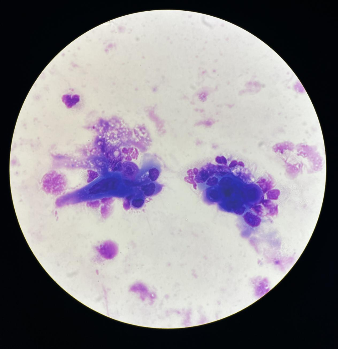 上皮细胞用什么染色尿液中 10 种上皮细胞镜检形态汇总，图片收集全啦！_https://www.jmylbn.com_新闻资讯_第22张