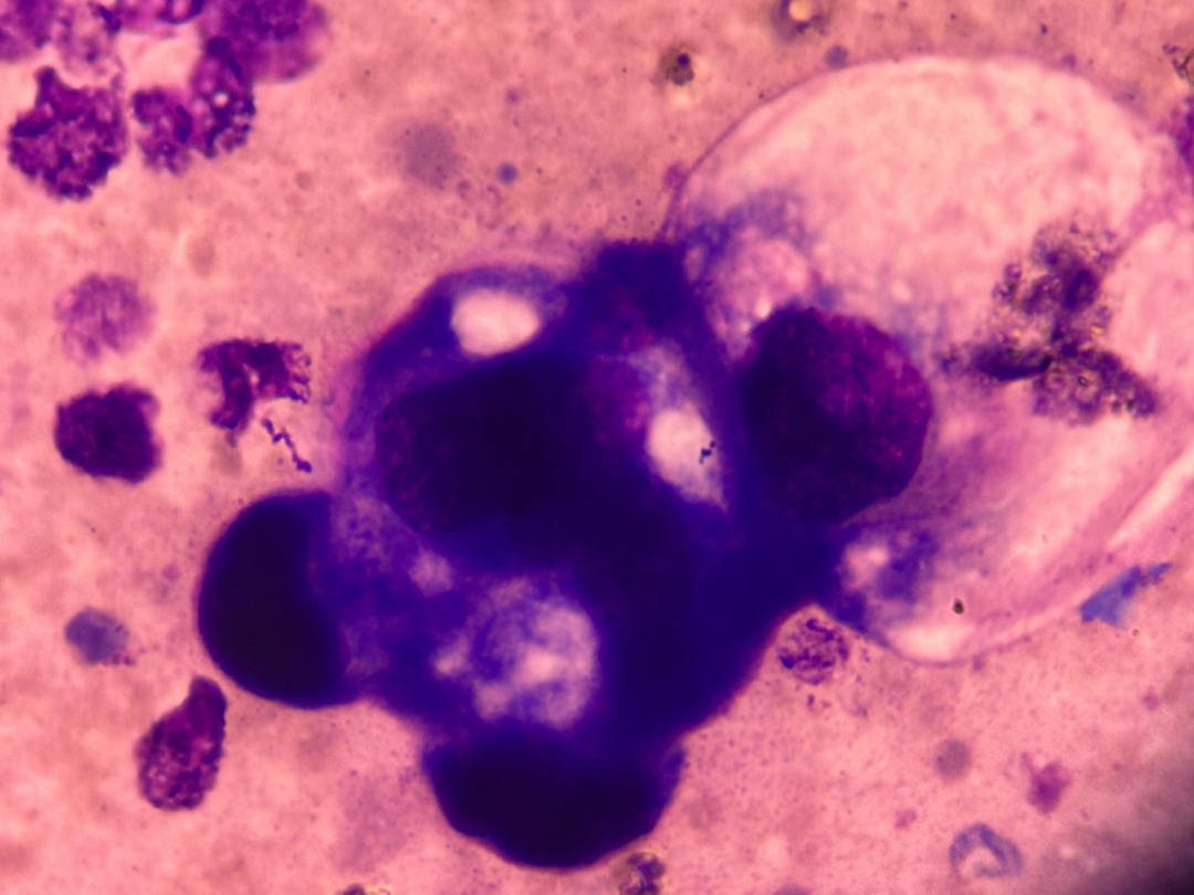 rbc直方图怎么看体液检测血细胞散点图看不懂？手把手教你分析_https://www.jmylbn.com_新闻资讯_第12张