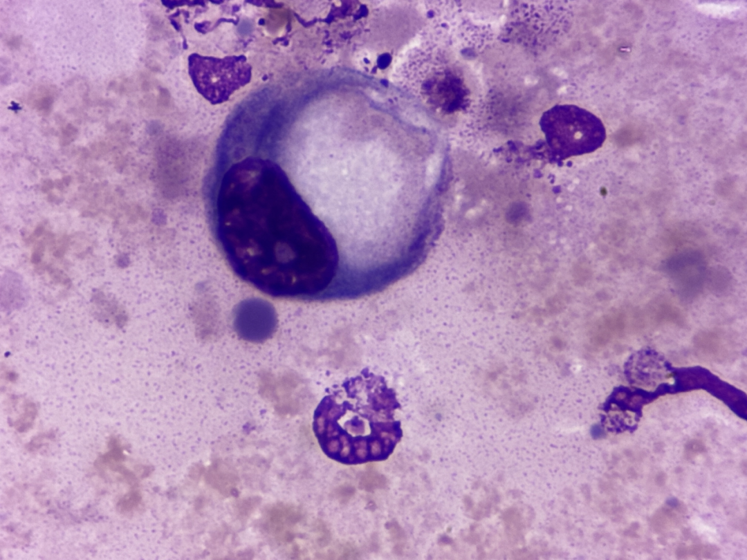 rbc直方图怎么看体液检测血细胞散点图看不懂？手把手教你分析_https://www.jmylbn.com_新闻资讯_第13张