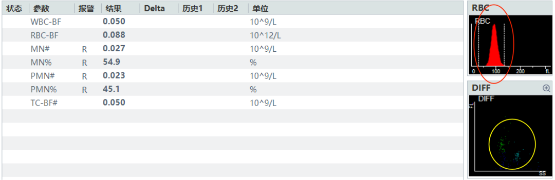 rbc直方图怎么看体液检测血细胞散点图看不懂？手把手教你分析_https://www.jmylbn.com_新闻资讯_第7张
