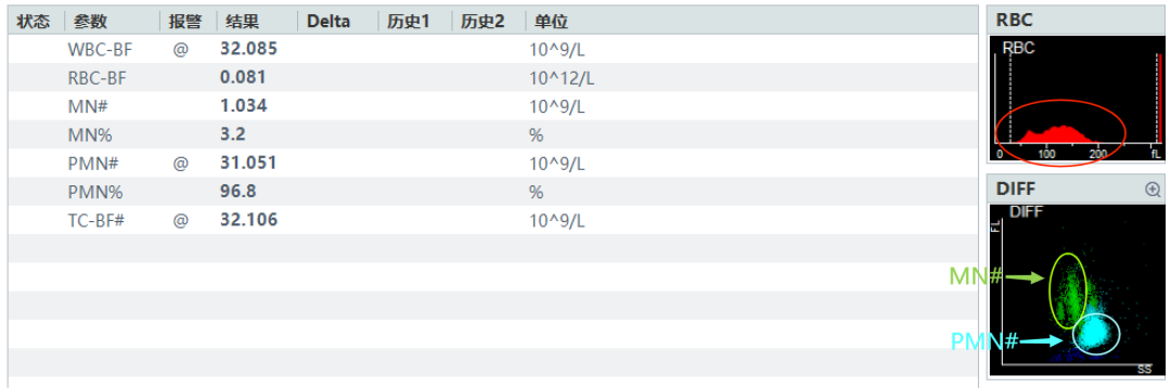 rbc直方图怎么看体液检测血细胞散点图看不懂？手把手教你分析_https://www.jmylbn.com_新闻资讯_第8张