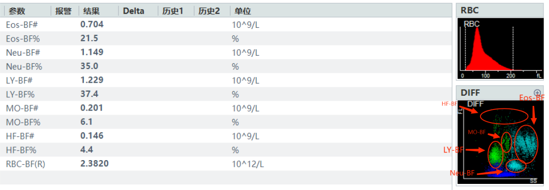 rbc直方图怎么看体液检测血细胞散点图看不懂？手把手教你分析_https://www.jmylbn.com_新闻资讯_第9张