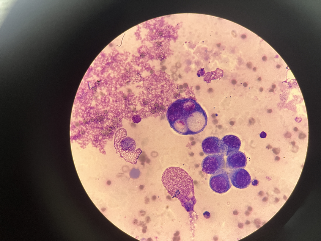 rbc直方图怎么看体液检测血细胞散点图看不懂？手把手教你分析_https://www.jmylbn.com_新闻资讯_第14张