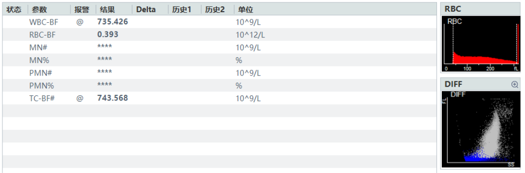 rbc直方图怎么看体液检测血细胞散点图看不懂？手把手教你分析_https://www.jmylbn.com_新闻资讯_第10张