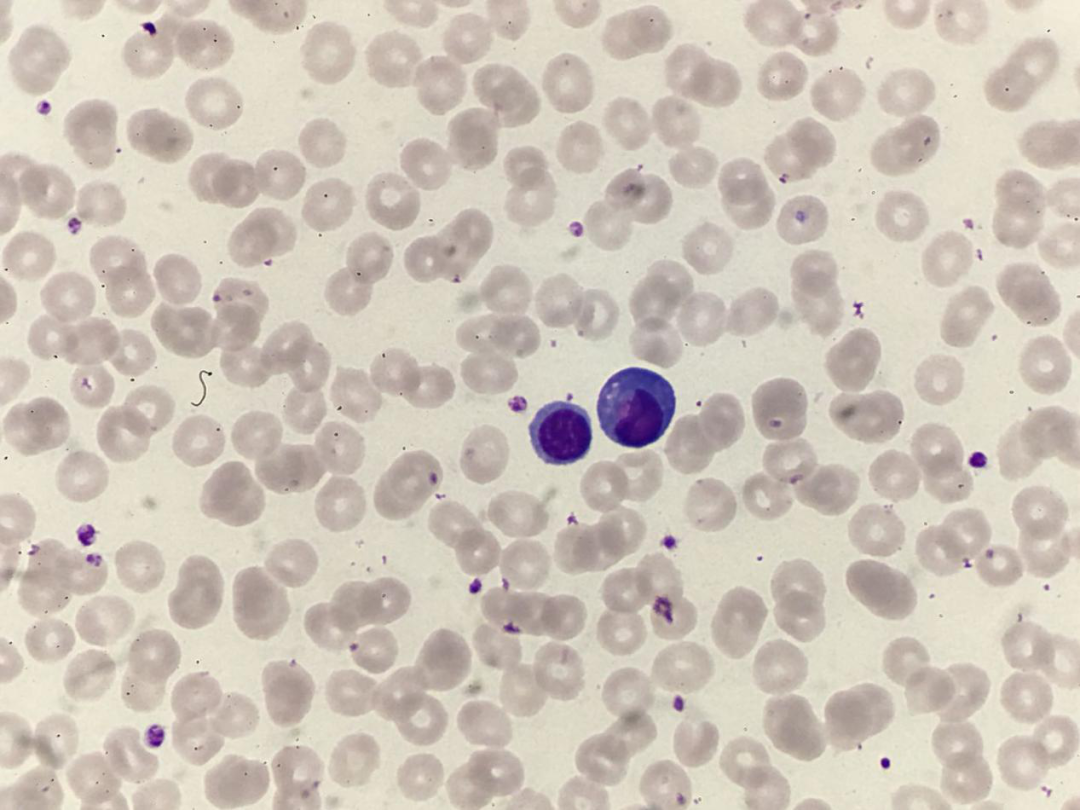 血常规用什么仪器检查荒唐：数十次血常规检查都出错，2 家医院误诊健康人患病治疗 4 年！_https://www.jmylbn.com_新闻资讯_第11张