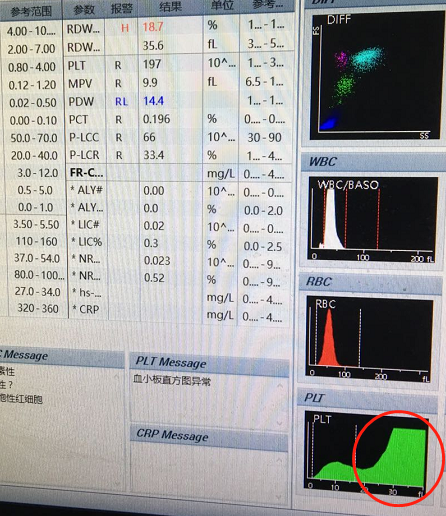 血常规用什么仪器检查荒唐：数十次血常规检查都出错，2 家医院误诊健康人患病治疗 4 年！_https://www.jmylbn.com_新闻资讯_第12张