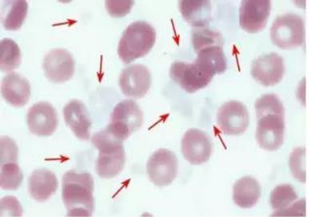 血常规用什么仪器检查荒唐：数十次血常规检查都出错，2 家医院误诊健康人患病治疗 4 年！_https://www.jmylbn.com_新闻资讯_第15张