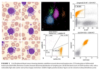 血常规用什么仪器检查荒唐：数十次血常规检查都出错，2 家医院误诊健康人患病治疗 4 年！_https://www.jmylbn.com_新闻资讯_第14张