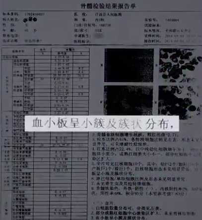 血常规用什么仪器检查荒唐：数十次血常规检查都出错，2 家医院误诊健康人患病治疗 4 年！_https://www.jmylbn.com_新闻资讯_第3张