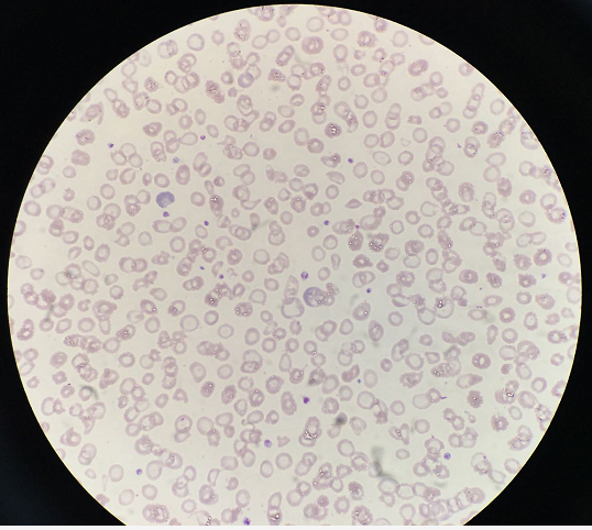 血常规用什么仪器检查荒唐：数十次血常规检查都出错，2 家医院误诊健康人患病治疗 4 年！_https://www.jmylbn.com_新闻资讯_第13张