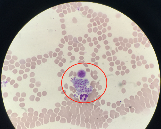 血常规用什么仪器检查荒唐：数十次血常规检查都出错，2 家医院误诊健康人患病治疗 4 年！_https://www.jmylbn.com_新闻资讯_第10张