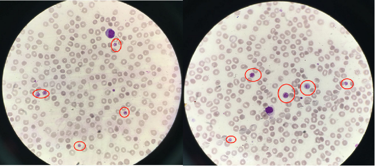 血常规用什么仪器检查荒唐：数十次血常规检查都出错，2 家医院误诊健康人患病治疗 4 年！_https://www.jmylbn.com_新闻资讯_第8张