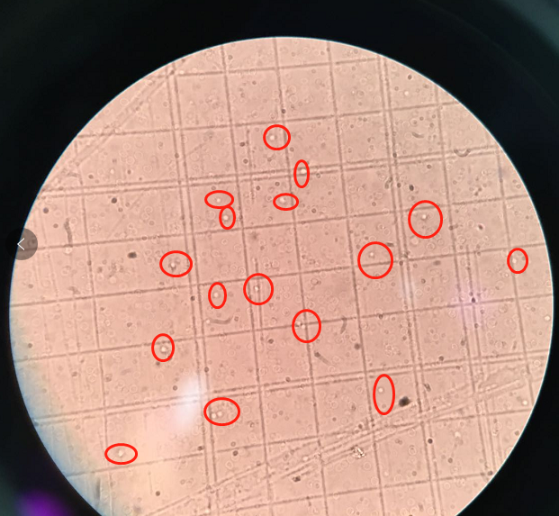 血常规用什么仪器检查荒唐：数十次血常规检查都出错，2 家医院误诊健康人患病治疗 4 年！_https://www.jmylbn.com_新闻资讯_第9张