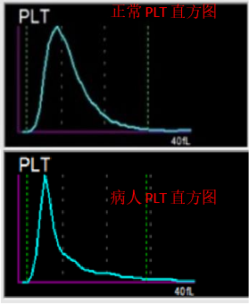 血常规用什么仪器检查荒唐：数十次血常规检查都出错，2 家医院误诊健康人患病治疗 4 年！_https://www.jmylbn.com_新闻资讯_第16张