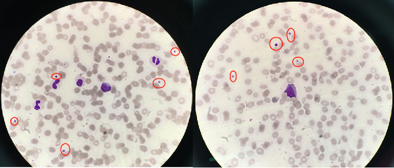 血常规用什么仪器检查荒唐：数十次血常规检查都出错，2 家医院误诊健康人患病治疗 4 年！_https://www.jmylbn.com_新闻资讯_第7张