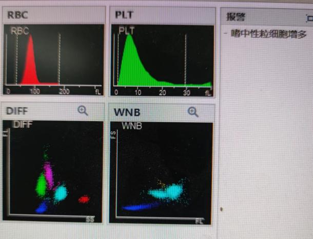 尿沉渣仪器怎么使用检验报告审核 “十大坑” ！90%的检验人都逃不掉..._https://www.jmylbn.com_新闻资讯_第3张
