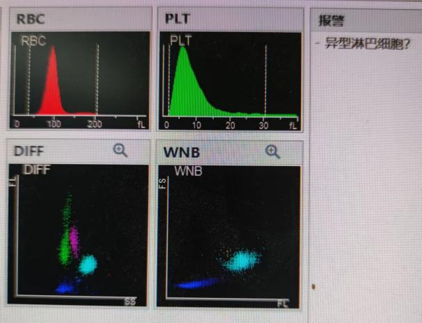 尿沉渣仪器怎么使用检验报告审核“十大坑”！90%的检验人都逃不掉_https://www.jmylbn.com_新闻资讯_第2张