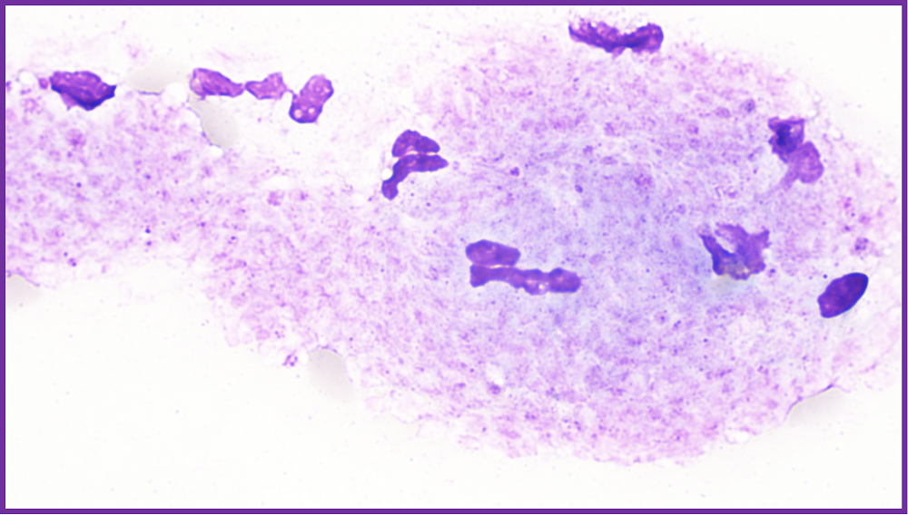 rbc直方图怎么看遇到异常标本，血常规怎么做？看这篇就够了_https://www.jmylbn.com_新闻资讯_第8张
