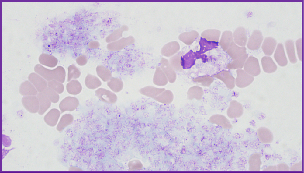 rbc直方图怎么看遇到异常标本，血常规怎么做？看这篇就够了_https://www.jmylbn.com_新闻资讯_第7张