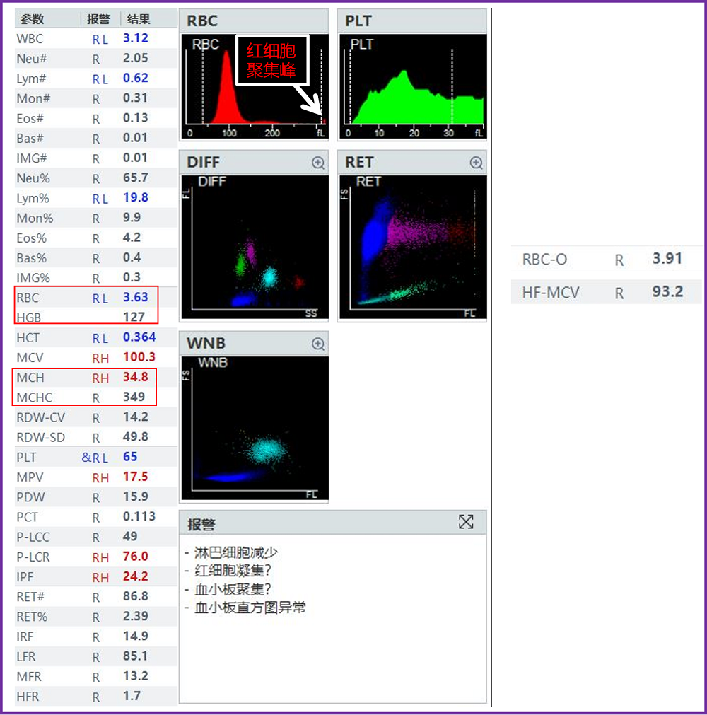 rbc直方图怎么看遇到异常标本，血常规怎么做？看这篇就够了_https://www.jmylbn.com_新闻资讯_第4张