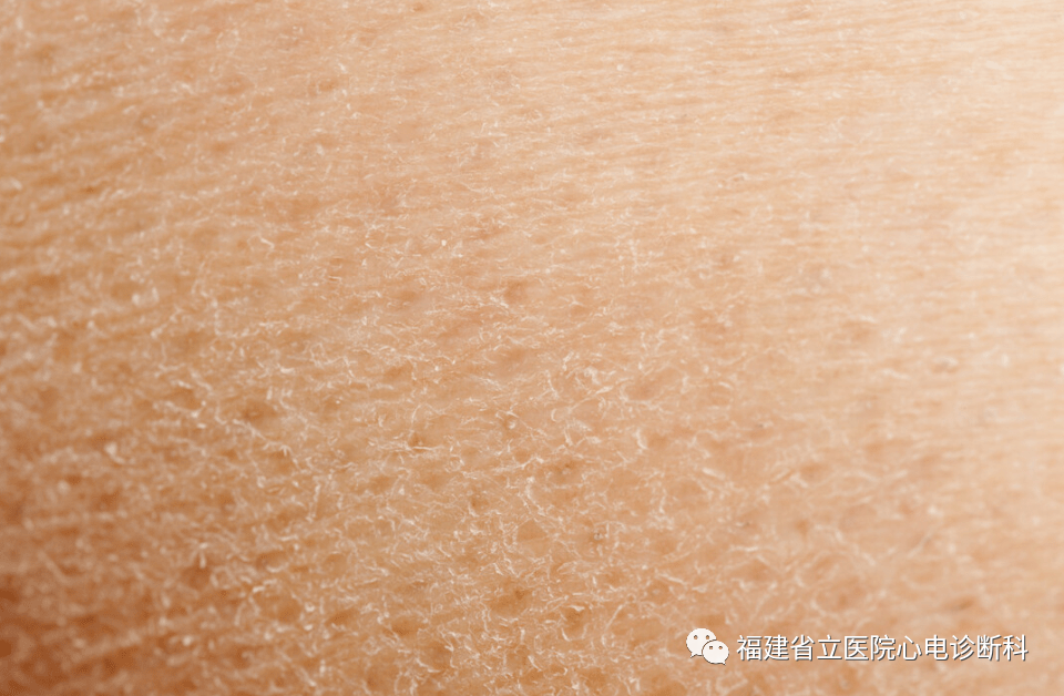 怎么装动态心电图浅谈“动态心电图”_https://www.jmylbn.com_新闻资讯_第12张