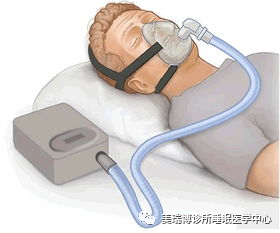 睡眠呼吸机怎么调节治疗睡眠呼吸暂停，如何正确选择呼吸机？_https://www.jmylbn.com_新闻资讯_第2张