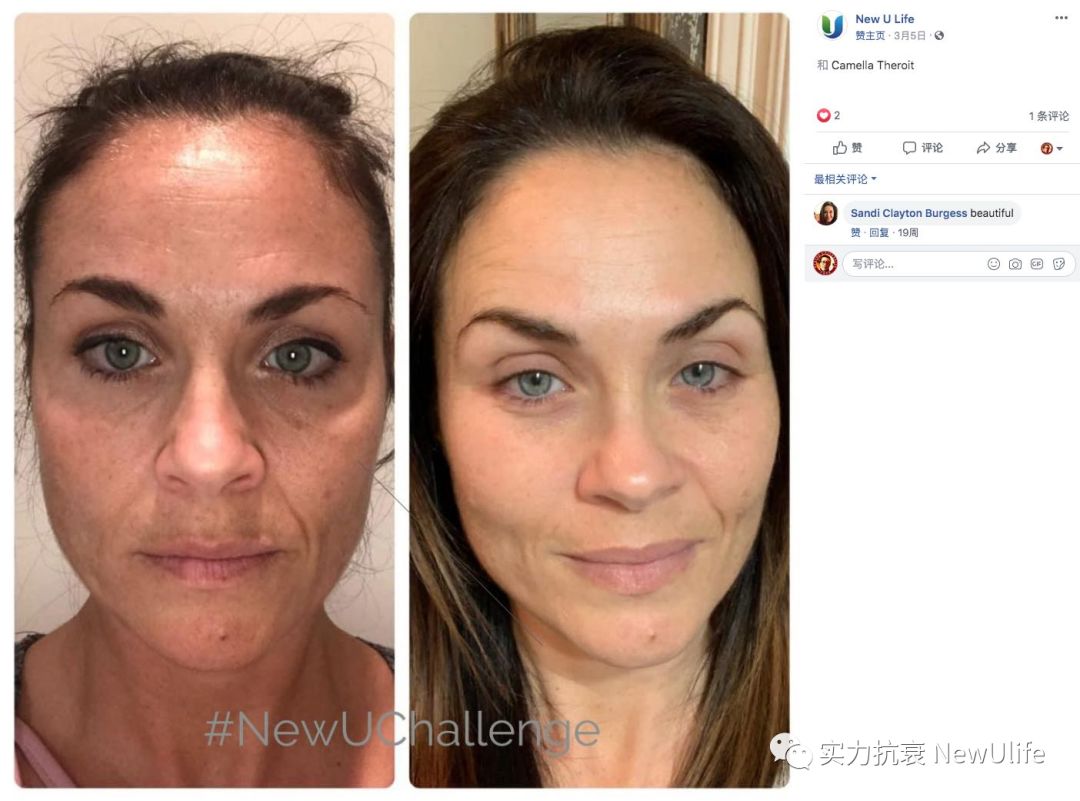 见证HGH凝胶的神奇，你还在犹豫吗