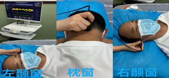 彩色经颅多普勒是什么【健康科普】经颅多普勒超声（TCD）——看透你的脑！_https://www.jmylbn.com_新闻资讯_第5张