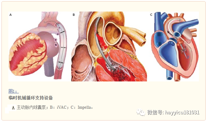 静脉治疗设备有哪些急性心力衰竭的临时性机械循环支持治疗_https://www.jmylbn.com_新闻资讯_第3张