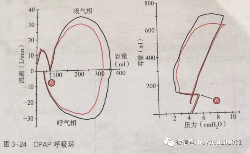 呼吸机怎么读卡各种通气模式波形汇总及其解读【收藏】_https://www.jmylbn.com_新闻资讯_第24张