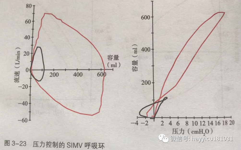 呼吸机怎么读卡各种通气模式波形汇总及其解读【收藏】_https://www.jmylbn.com_新闻资讯_第23张