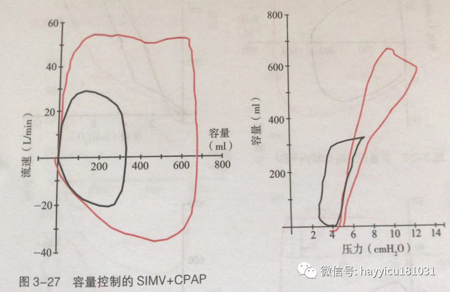 呼吸机怎么读卡各种通气模式波形汇总及其解读【收藏】_https://www.jmylbn.com_新闻资讯_第27张