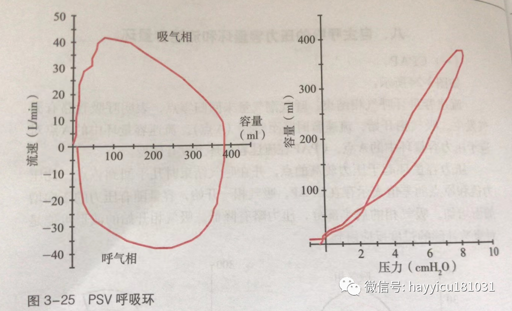 呼吸机怎么读卡各种通气模式波形汇总及其解读【收藏】_https://www.jmylbn.com_新闻资讯_第25张
