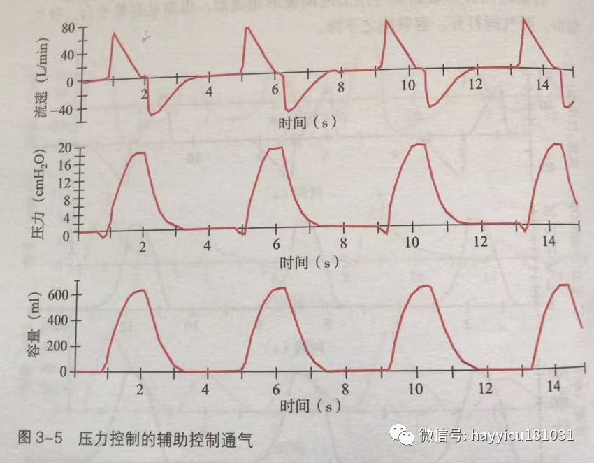 呼吸机怎么读卡各种通气模式波形汇总及其解读【收藏】_https://www.jmylbn.com_新闻资讯_第5张