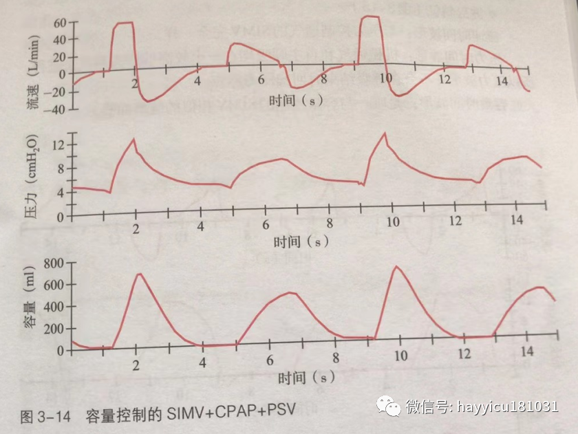 呼吸机怎么读卡各种通气模式波形汇总及其解读【收藏】_https://www.jmylbn.com_新闻资讯_第14张