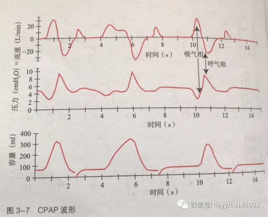 呼吸机怎么读卡各种通气模式波形汇总及其解读【收藏】_https://www.jmylbn.com_新闻资讯_第7张