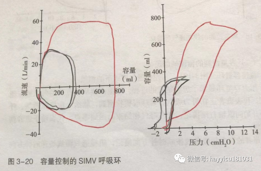 呼吸机怎么读卡各种通气模式波形汇总及其解读【收藏】_https://www.jmylbn.com_新闻资讯_第20张