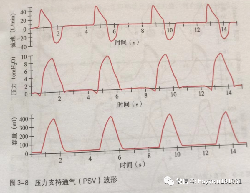 呼吸机怎么读卡各种通气模式波形汇总及其解读【收藏】_https://www.jmylbn.com_新闻资讯_第8张