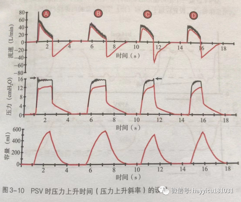 呼吸机怎么读卡各种通气模式波形汇总及其解读【收藏】_https://www.jmylbn.com_新闻资讯_第10张
