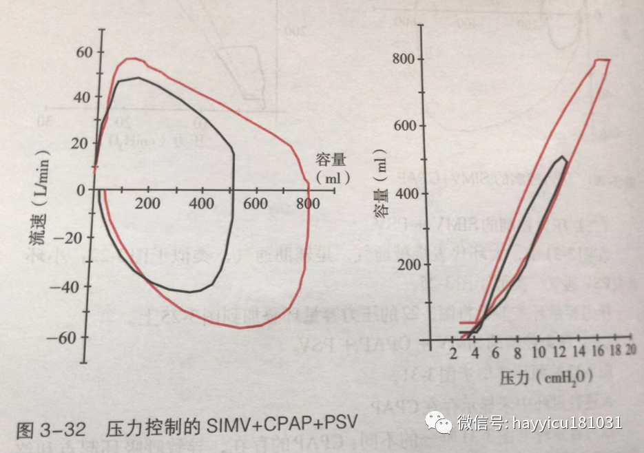 呼吸机怎么读卡各种通气模式波形汇总及其解读【收藏】_https://www.jmylbn.com_新闻资讯_第32张