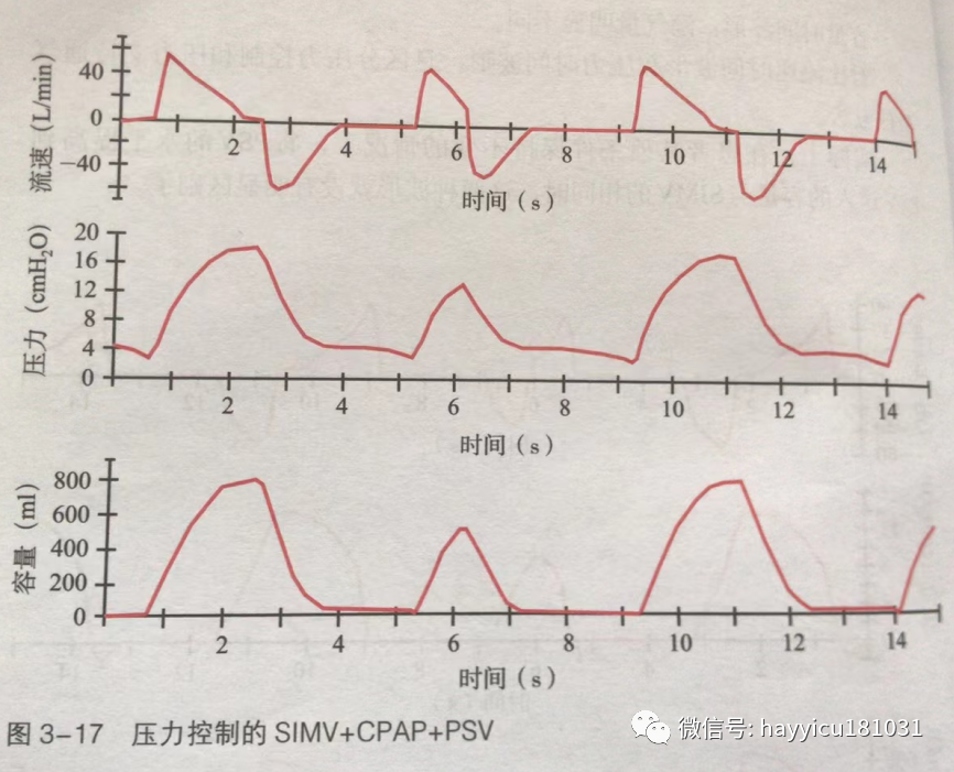 呼吸机怎么读卡各种通气模式波形汇总及其解读【收藏】_https://www.jmylbn.com_新闻资讯_第17张