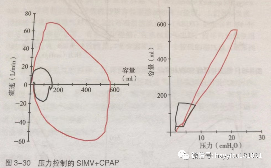 呼吸机怎么读卡各种通气模式波形汇总及其解读【收藏】_https://www.jmylbn.com_新闻资讯_第30张