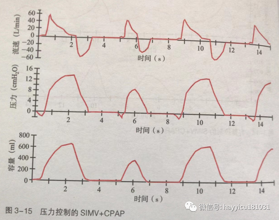 呼吸机怎么读卡各种通气模式波形汇总及其解读【收藏】_https://www.jmylbn.com_新闻资讯_第15张