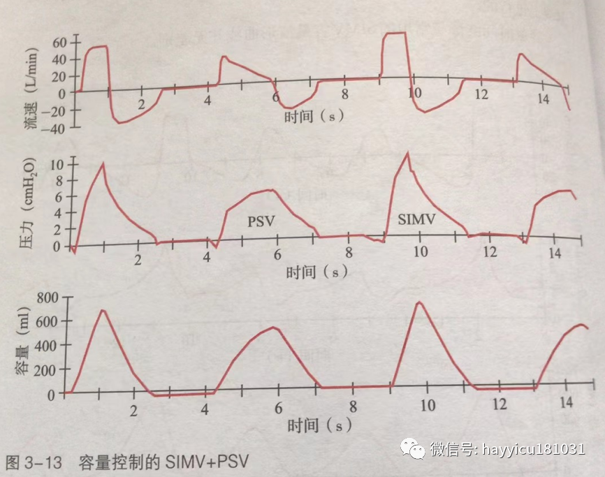 呼吸机怎么读卡各种通气模式波形汇总及其解读【收藏】_https://www.jmylbn.com_新闻资讯_第13张