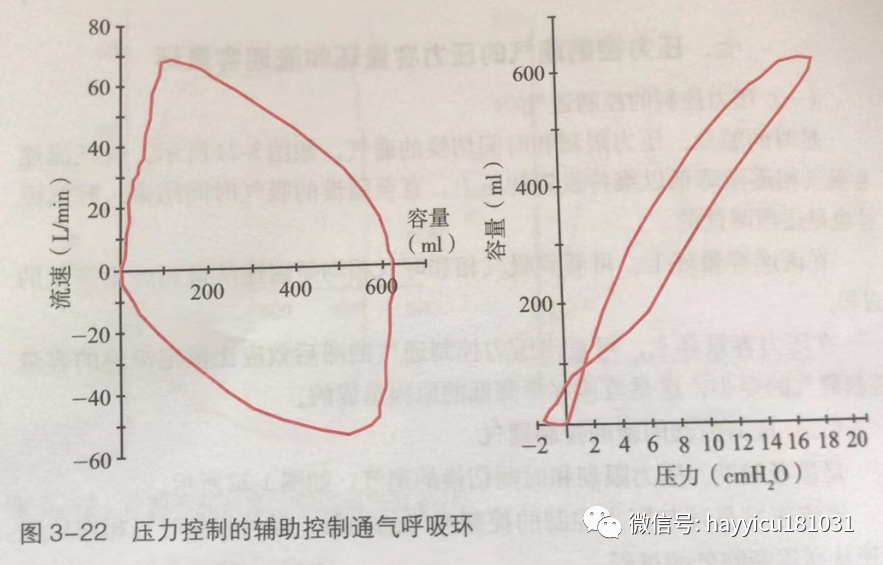 呼吸机怎么读卡各种通气模式波形汇总及其解读【收藏】_https://www.jmylbn.com_新闻资讯_第22张