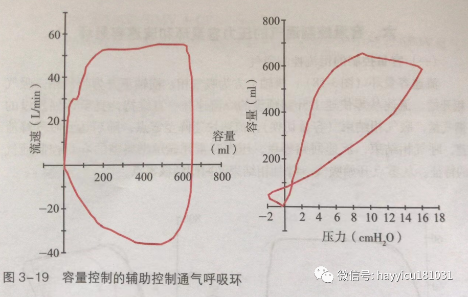 呼吸机怎么读卡各种通气模式波形汇总及其解读【收藏】_https://www.jmylbn.com_新闻资讯_第19张